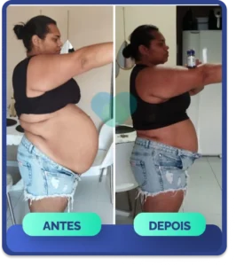 nova-antes-e-depois.webp